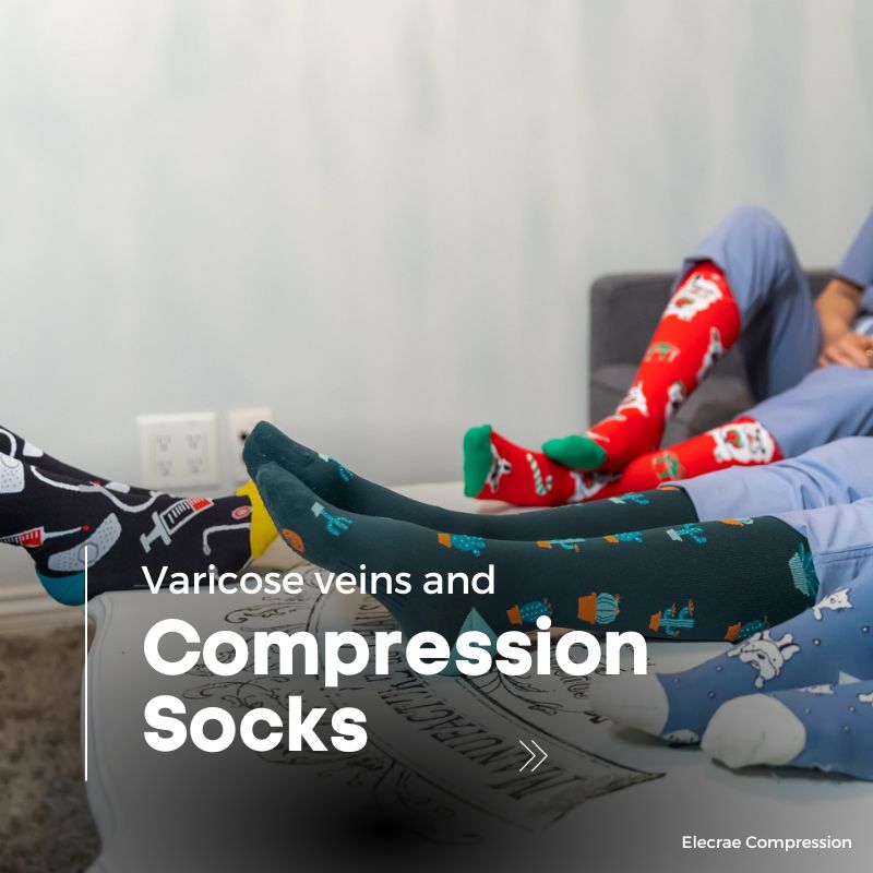 Compression Socks for Varicose Veins: Managing and Preventing a Common Condition